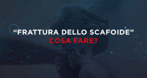 "frattura dello scafoide" cosa fare?